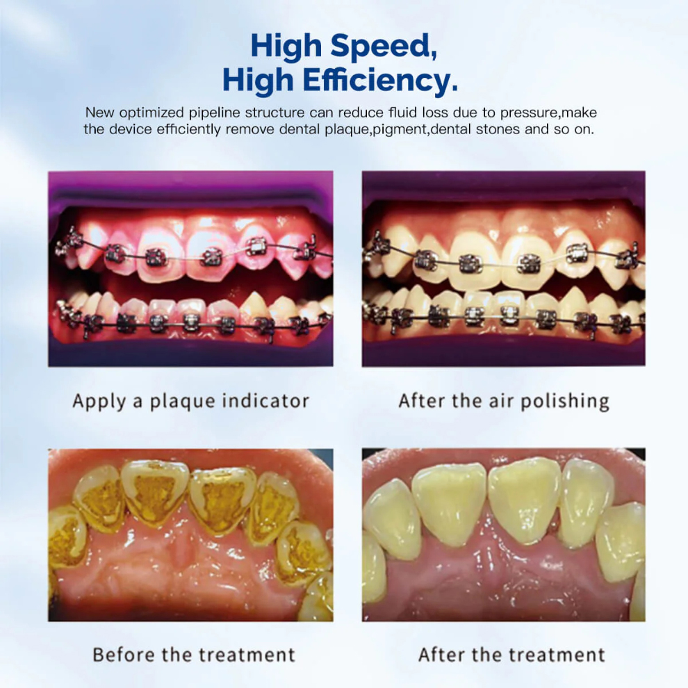 VRN® DQ-40 Periodontal Treatment Device With Ultrasonic Scaler and Dental Air Polisher